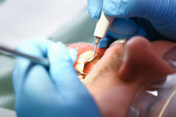Best Urgent Dental Care for Toothaches in Frontenac, KS