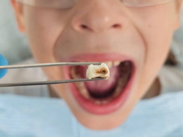 Best Emergency Root Canal Therapy in Frontenac, KS