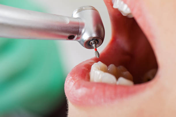 Professional Emergency Dental Service in KS